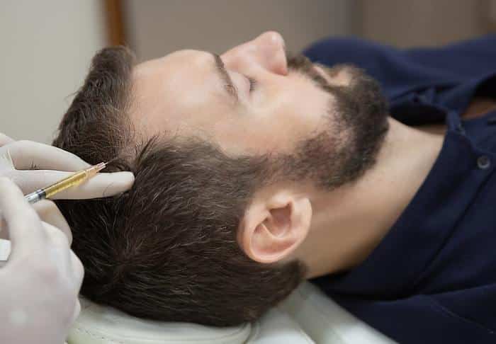 man getting hair loss injections
