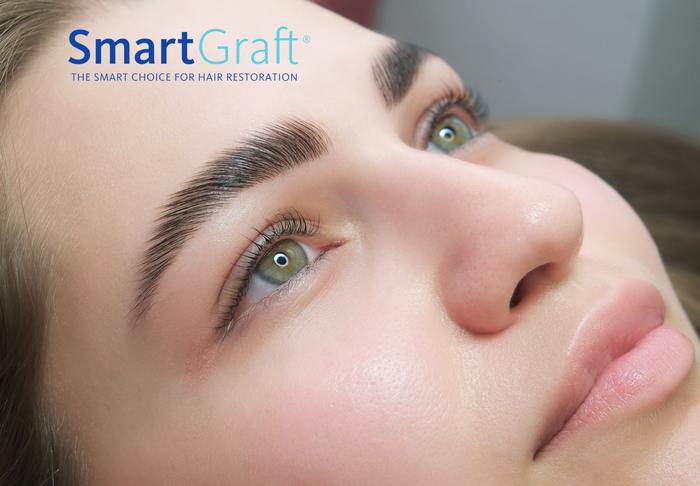 smartgraft smart choice for hair restoration
