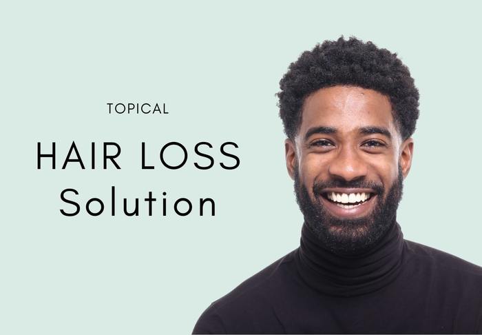 topical hair loss solution houston tx