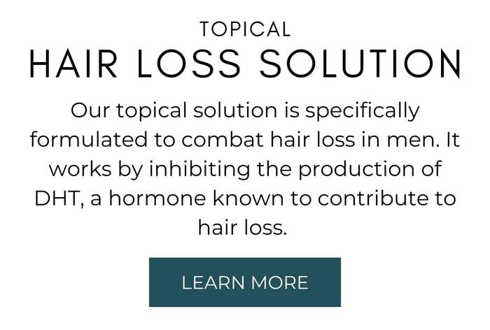 topical hair loss solution houston